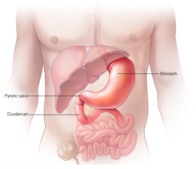 s00758_im02665_r7_pyloricvalve_jpg