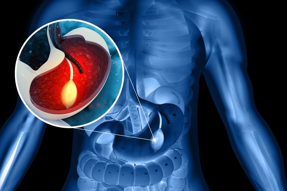 gastroskopisi proetoimasia γαστροσκόπηση προετοιμασία